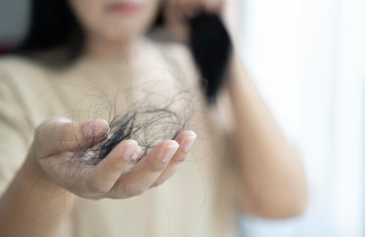 minyak kemiri, rambut rontok pasca melahirkan, kemiri untuk rambut, manfaat kemiri, perawatan rambut alami ibu muda, herbal rambut rontok, solusi rambut sehat alami